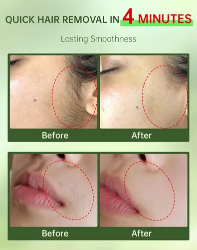 Vista 3 de Crema de depilación facial sin dolor para mujeres - Kit 2 en 1 con crema calmante para piel sensible Removedor de vello de labio superior