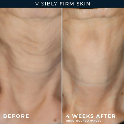 Vista 11 de RoC Crepe Repair Crema hidratante facial diaria antienvejecimiento y crema reafirmante para el cuello (1.7 onzas) + cápsulas suavizantes RoC Retinol
