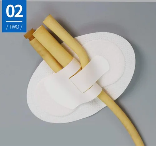 Vista 4 de Lifevv 5 soportes para catéter para piernas, dispositivo de fijación de tubo de superficie con catéter antideslizante, correa de pierna