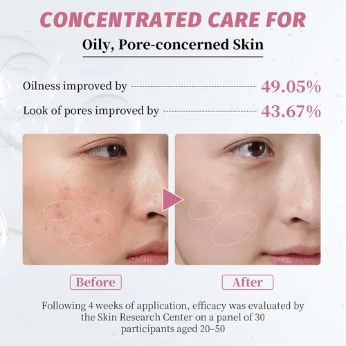Vista 4 de Suero de niacinamida 10% + zinc 2% – Suero facial iluminador con ácido hialurónico y arbutina para piel nutrida, equilibrada y propensa – 1 onza