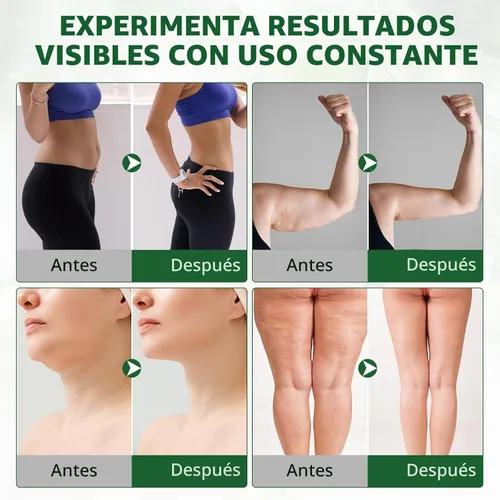 Vista 5 de Suplementos de drenaje linfático, apoya la hinchazón y el bienestar