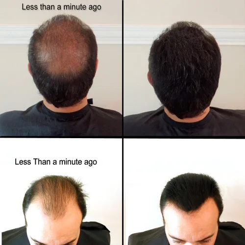 Vista 3 de para cabello adelgazante - Fórmula natural 100% indetectable - Oculta completamente la pérdida de cabello en segundos. Cubre las calvas. Espesa tu
