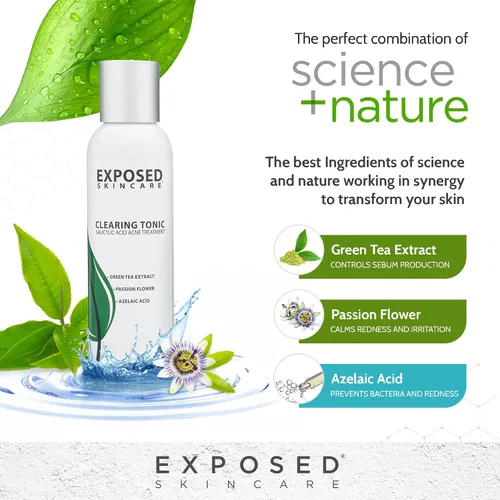 Vista 8 de Exposed Skin Care, Clearing Tonic - Tónico facial con 1% de ácido salicílico y hamamelis, tónico diario para acné de adolescentes y adultos, puntos