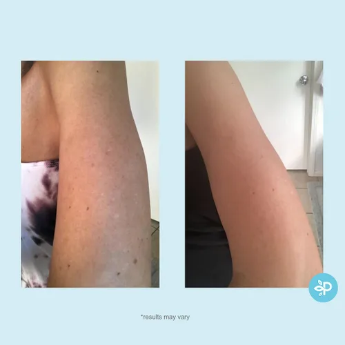 Vista 5 de Hydro-Glo - Almohadillas mejoradas con extractos kójico, mandélico, glutatión, regaliz, papaya, piña, gaya, gayuba (10% de fuerza de pelado)