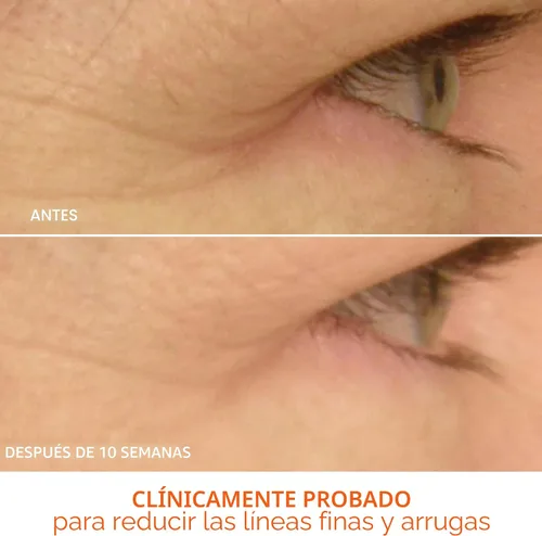 Vista 6 de Dr. Dennis Gross DRx SpectraLite EyeCare Max Pro - Dispositivo LED
