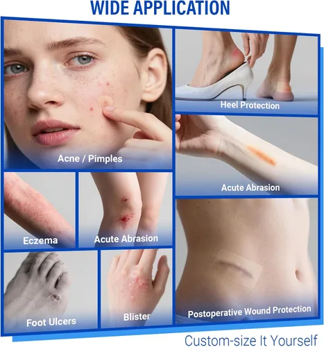 Vista 3 de MasterMo Rollo hidrocoloide para el cuidado de heridas, vendas hidrocoloides extra grandes de grado médico de 2 pulgadas x 16 pies con autoadhesivo