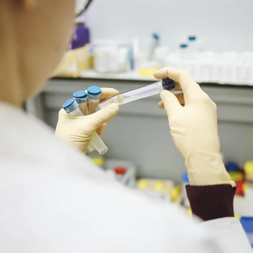 Vista 6 de Paquete de 10 tubos centrífugos cónicos de vidrio de 0.5 fl oz, tubos de ensayo graduados con tapones de rosca a prueba de fugas, frascos