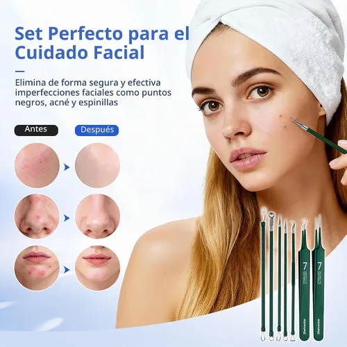 Vista 2 de Kit de herramientas para reventar espinillas, kit de 7 piezas de extractor de espinillas con caja para eliminar rápida y fácilmente espinillas