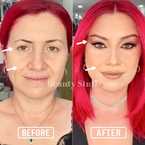 Vista 6 de Lift 'Em Up - Cintas de estiramiento facial, 20 cintas hipoalergénicas hechas en Estados Unidos para levantamiento de ojos, estiramiento facial