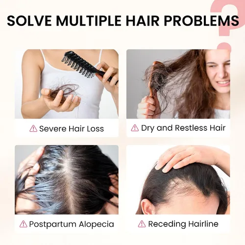 Vista 3 de Suplemento para el crecimiento del cabello, apoyo para el cuidado del cabello para fortaleza, crecimiento de espesor, con biotina vitamina A, C, E