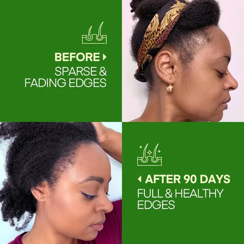 Vista 2 de Svvimer Aceite de batana para el crecimiento del cabello, Dr. Sebi 100% puro y crudo de Honduras, orgánico y natural, promueve el grosor del cabello
