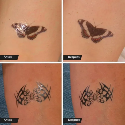 Vista 3 de Godefroy TatLast - Reducción temporal del brillo del tatuaje y solución protectora para una vida más larga, 0.27 onzas