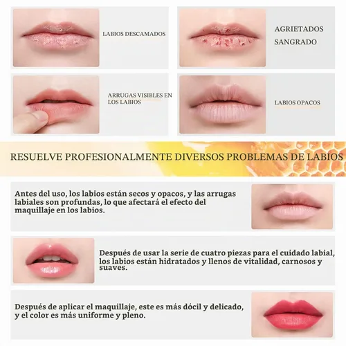 Vista 6 de Kit de cuidado de labios de 4 piezas con leche de miel, bálsamo