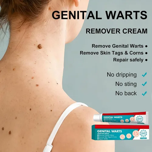 Vista 2 de Crema eliminadora de verrugas gencial de acción rápida para hombres y mujeres, crema para eliminar verrugas para todo el cuerpo, 0.71 oz