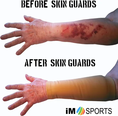 Vista 2 de SKIN GUARDS - Mangas de protección para la piel del antebrazo, protege el envejecimiento o la piel fina, protección UV, unisex, fabricadas