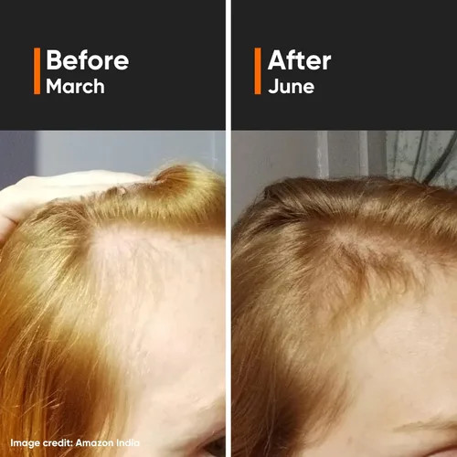 Vista 9 de Minimalist Suero de densidad capilar 18% Con Procapil, Capixyl, Redensyl, Anagain y Baicapil para el control de caídas del cabello Mujeres