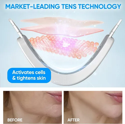 Vista 3 de Máquina reductora de mentón doble, masajeador facial de línea V, masajeador facial de moldeo portátil con luz azul para mejorar el contorno facial