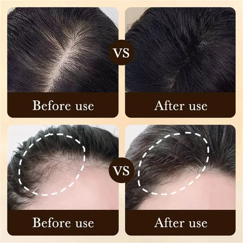 Vista 4 de 2-Deoxy-D-Ribosa Gel De Azúcar, 2.0 fl oz Gel De Desoxirribosa Para La Caída Del Cabello