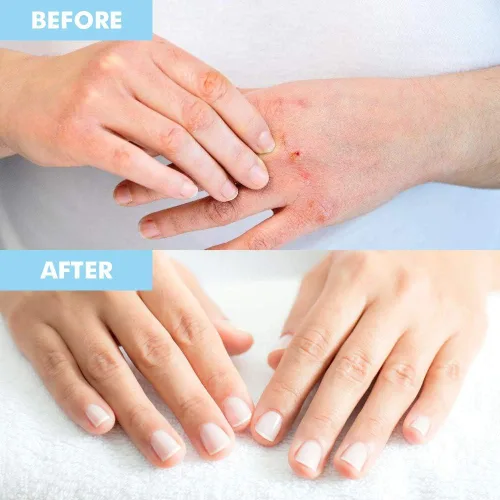 Vista 5 de Bodipure Máscara prémium para manos y pies Guantes y calcetines hidratantes Kertain Hidratante manos secas y apagadas, talones agrietados
