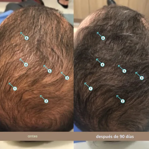 Vista 4 de DS Labs Spectral Suero para la Densidad Capilar Masculina (anteriormente Spectral.DNC-N), 60mL - Tratamiento Ligero de Uso Diario para un Cabello