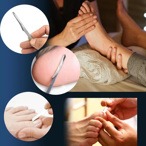 Vista 5 de 6 herramientas de uñas encarnadas, lima y levantadores de uñas de los pies, kit de herramientas profesionales de eliminación de uñas de acero