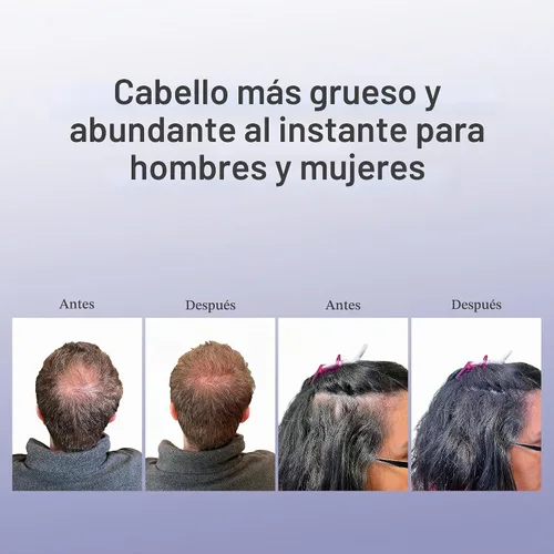 Vista 5 de Bosley solidez profesional pelo volumen fibras Negro