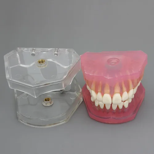 Vista 3 de Modelo de dientes de implante dental con dientes extraíbles para profesionales dentales y estudiantes