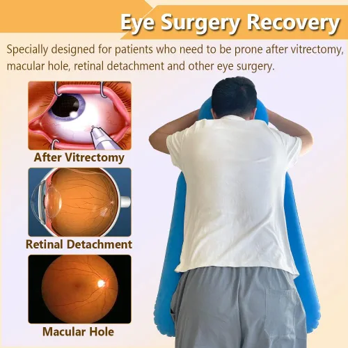 Vista 3 de Almohada boca abajo después de cirugía ocular, almohada propensa con agujero para el brazo para dormir, desprendimiento de retina, recuperación