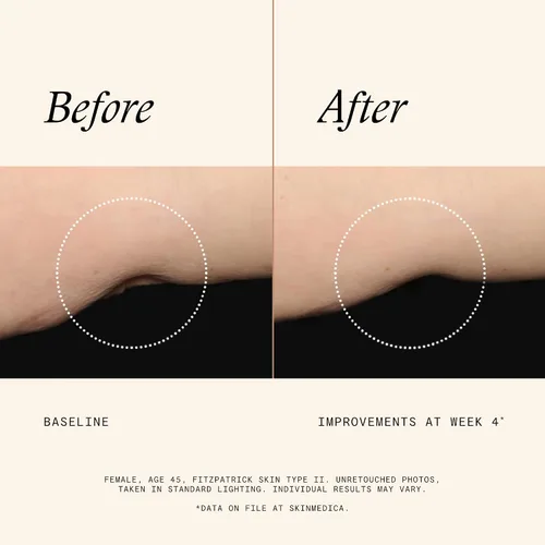 Vista 4 de SkinMedica Loción firme y tonificante para el cuerpo: loción corporal ideal para abordar los signos visibles de piel seca o envejecida para un