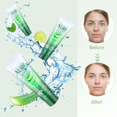 Vista 4 de Gel de aloe vera de 200 x 0.1 fl oz, 99% orgánico puro aloe vera hidratante facial y corporal, crema de aloe natural para piel seca, quemaduras
