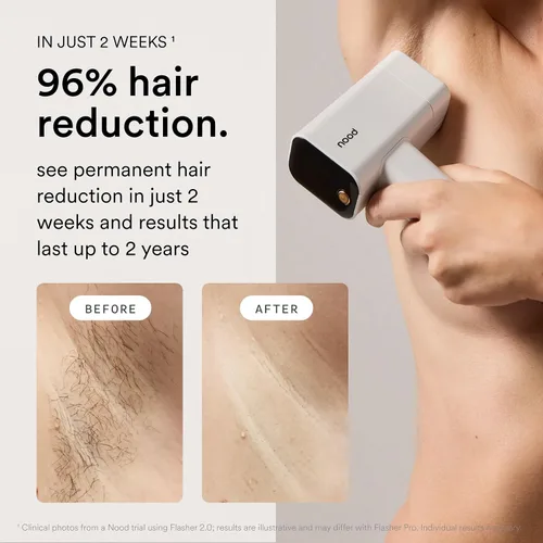 Vista 3 de Nood™ Nuevo Flasher Pro + suero de crecimiento lento: dispositivo de depilación láser IPL para mujeres y hombres + suero para después del afeitado