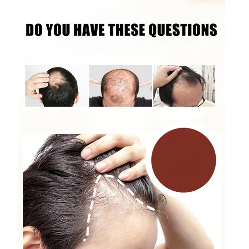 Vista 2 de 5% Minoxidil Hair Growth for Men and Women,Minoxidil Hair Growth Serum,Fast Regrowth & Strengthens Hair Roots,for Thinning Hair Loss to Grow Thicker