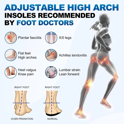Vista 3 de Plantillas ortopédicas extraíbles 3/4 para alivio de la fascitis plantar, alivio del dolor de pie todo el día, dolor de rodilla, sobrepronación