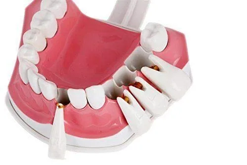 Vista 3 de Enseñanza de la enfermedad Dientes Modelo de Educación de Estudio con un Cepillo de Dientes