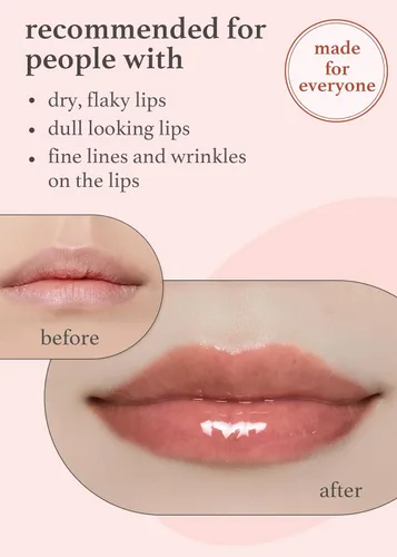 Vista 5 de NOONI Aceite de labios vegano coreano – Appleginseng, 0.12 onzas líquidas + aceite de labios coreano – Applecoco, paquete de 0.12 onzas líquidas
