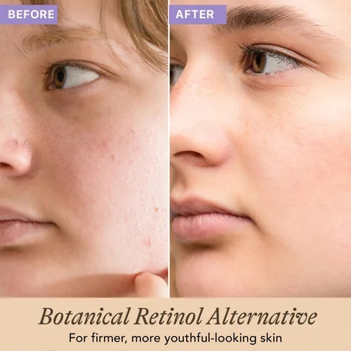 Vista 2 de Suero alternativo de Bakuchiol Bio Retinol, suaviza la piel y reduce las líneas finas, fabricado en Estados Unidos con ingredientes naturales