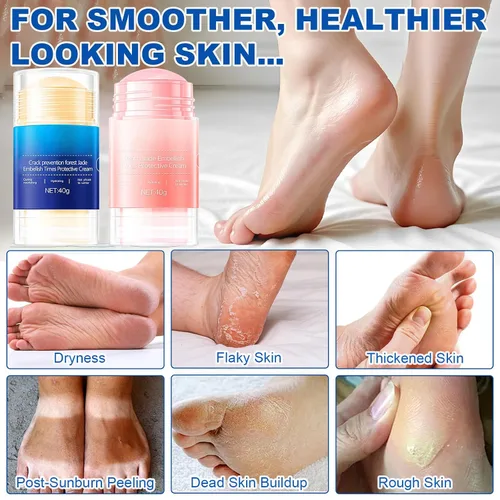 Vista 2 de Crack Feet - Barra de prevención de urea, 60 %, crema antigrietas para pies, crema hidratante para pies, crema suavizante y nutritiva, para talones