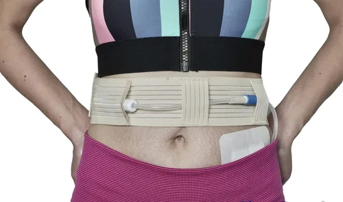 Vista 5 de Cinturón de catéter PD transpirable de diálisis peritoneal Soporte seguro de alimentación de tubo de clavija Suministros para diálisis PD