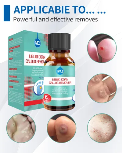 Vista 8 de MQ Líquido profesional removedor de maíz y callos para pies y dedos de los pies – Acción rápida para eliminación de maíz, piel dura y piel muerta