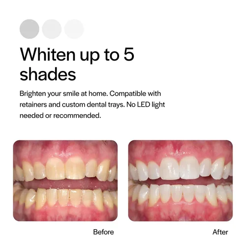 Vista 3 de Opalescence, PF 10% blanqueador dental, 8