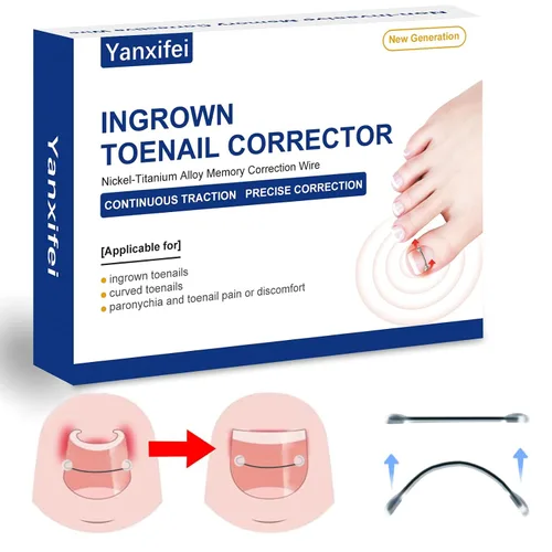 Vista 8 de Corrector de uñas encarnadas de nitinol dual, tratamiento de uñas encarnadas, enderezador de uñas curvas, kit de eliminación de uñas encarnadas