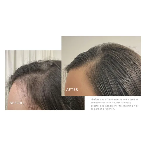 Vista 4 de VIRTUE Flourish Champú sin sulfato para cabello fino, Producto para el crecimiento y volumen del cabello, Desintoxica y repara, Seguro