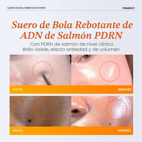 Vista 3 de FRANKLY Salmon PDRN Bounce Ball Serum – 99% Pure Salmon DNA PDRN para recuperación posterior a las microagujas, enrojecimiento y reparación