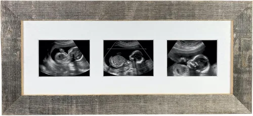 Vista 5 de BARNWOODUSA Marco de fotos Sonogram Marco de fotos de recuerdo de progresión de ultrasonido de bebé Marco de fotos de hitos del embarazo 1
