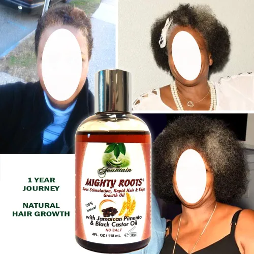 Vista 3 de FOUNTAIN Mighty Roots - Dañado - Receding - Bordes - Punto calvo - Aceite para adelgazar el cabello - Botella aplicadora - 4 onzas líquidas