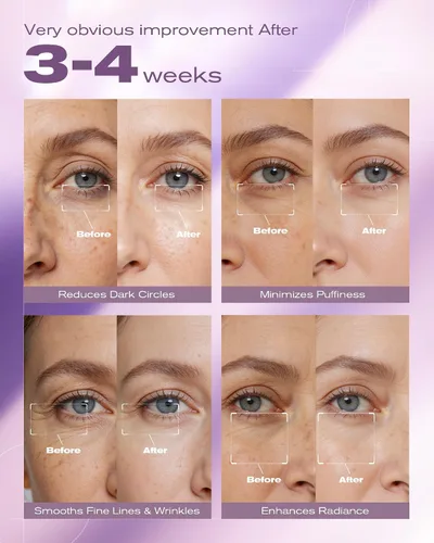 Vista 4 de Crema de ojos con 8% de cafeína y crema de retinol para reducir las ojeras, la hinchazón, las arrugas y las líneas finas, suero antienvejecimiento