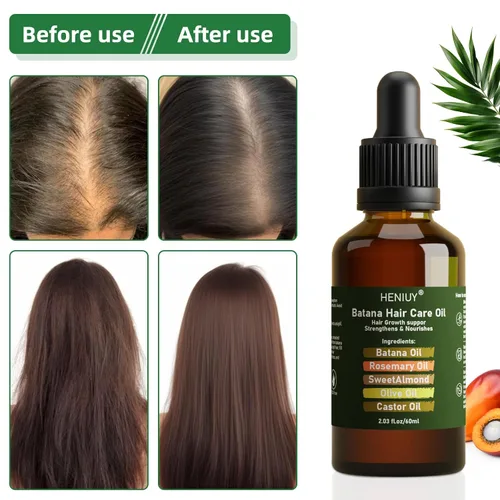 Vista 5 de Battana - Aceite para el cuidado del cabello, mezcla de aceite de romero natural y almendras dulces de 2 onzas líquidas para el crecimiento