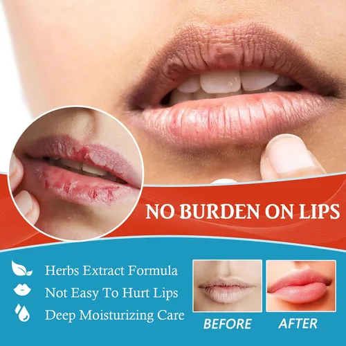 Vista 3 de Labios secos y agrietados, bálsamo labial curativo natural, crema orgánica para tratamiento de queilitis humectante durante todo el día, hombres