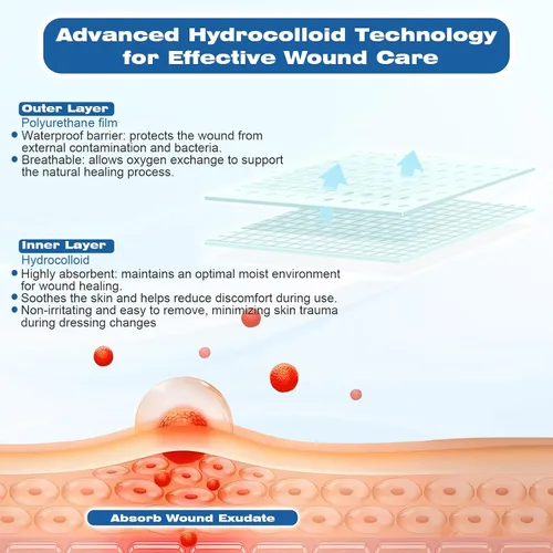 Vista 3 de Rollo hidrocoloide de grado médico para el cuidado de heridas, cortado a medida, flexible, impermeable y ultra absorbente
