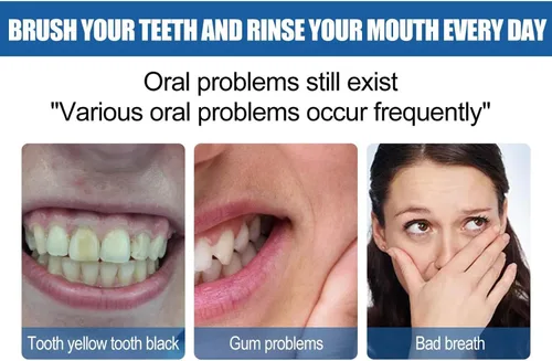 Vista 5 de Blanqueador de dientes en polvo, polvo de dientes de bicarbonato de sodio, sabor refrescante de menta, blanqueador de dientes eficaz, eliminación